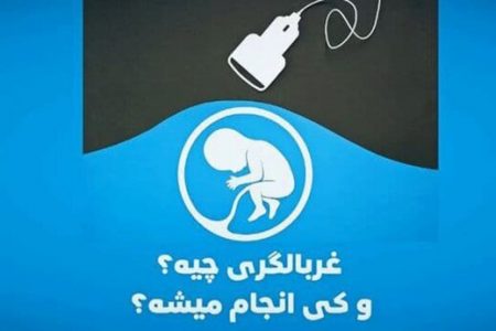آغاز جلوگیری از تست غربالگری با چراغ‌ خاموش؟
